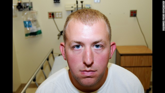 Darren Wilson’s Injuries After He Killed Michael Brown, Jr.
