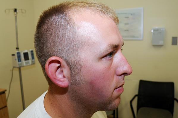 Darren Wilson’s Injuries After He Killed Michael Brown, Jr.