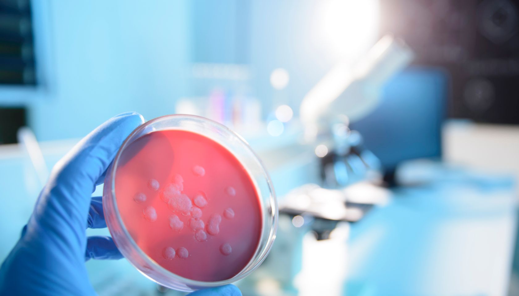 Microbiological Culture