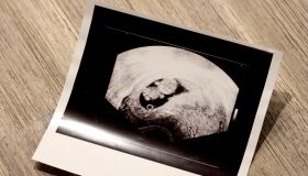 Ultrasound Photo Of A Human Fetus On Table