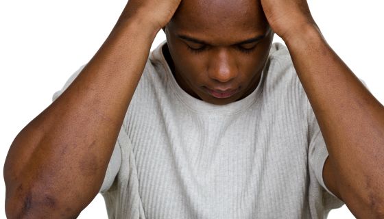 The Silent Strain: How Chronic Stress Impacts Black People’s Health