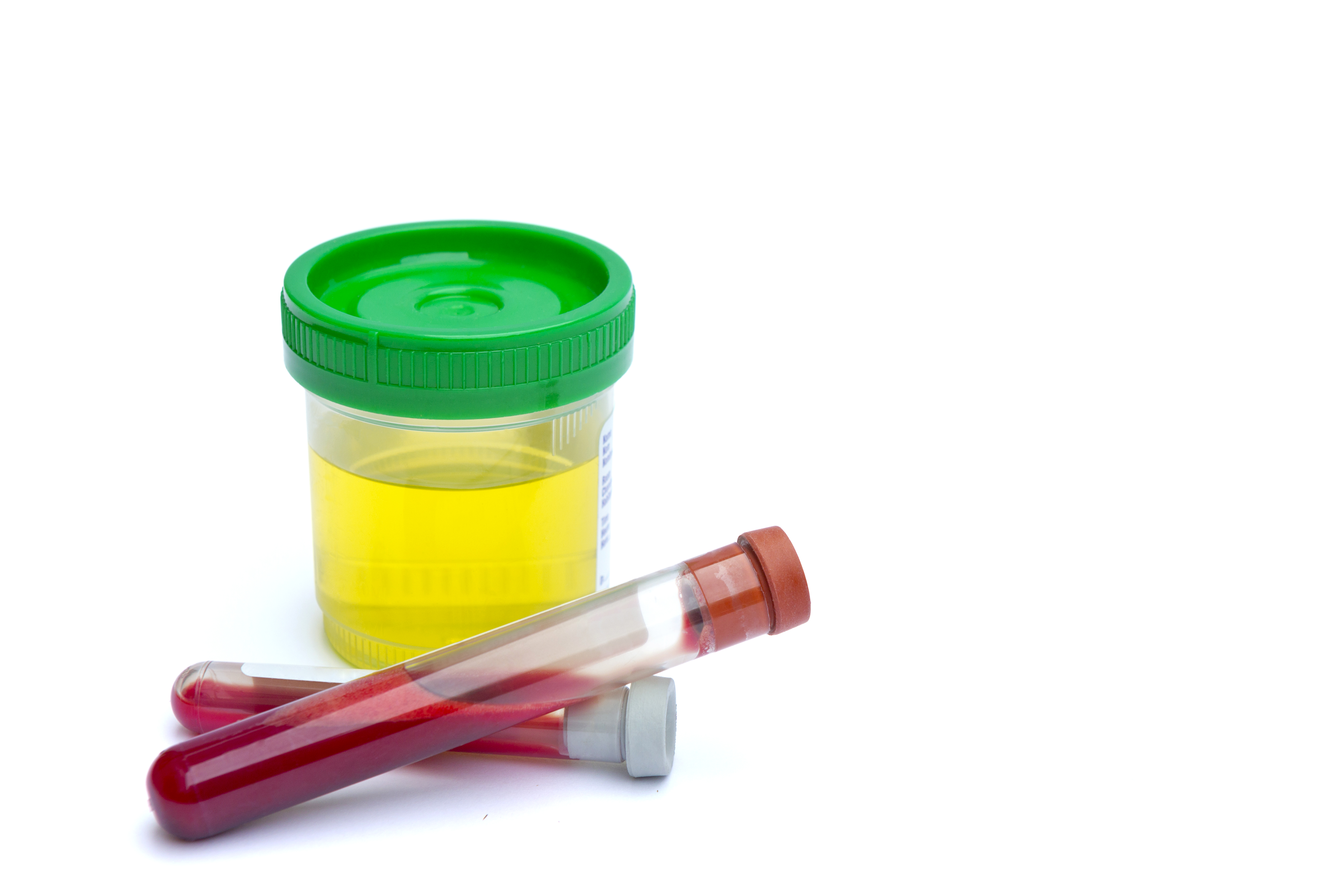 Medical: Sterile Urine sample and blood test