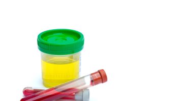 Medical: Sterile Urine sample and blood test