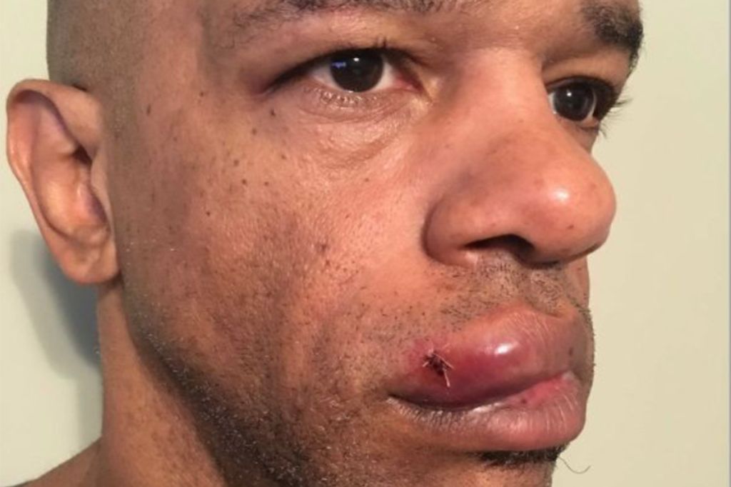 Luther Hall, St. Louis detective beaten by 3 white St. Louis cops