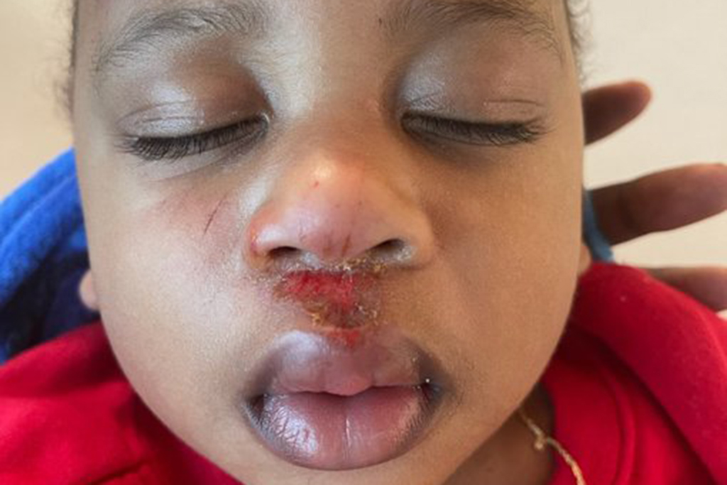 Pensacola police botched raid