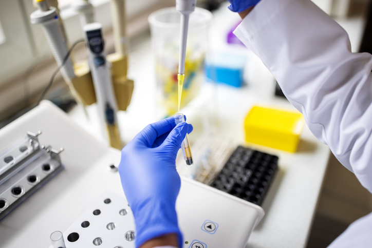 Scientist testing medical sample in lab