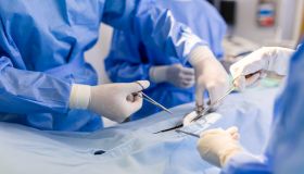 Group of surgeons doing surgery in hospital operating theater. Medical team doing critical operation. Group of surgeons in operating room with surgery equipment. Modern medical background