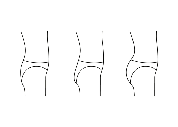 Types of butt woman, shape buttock side, line icon. Augmentation, reshape buttocks from small, flat in full booty. Cosmetic medical procedures, clinic of plastic surgery. Vector outline illustration