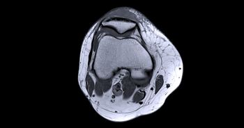 Magnetic resonance imaging or MRI of knee joint c for detect tear or sprain of the anterior cruciate ligament (ACL)