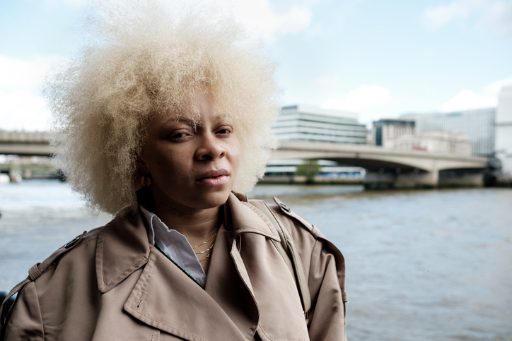 Albino african american woman posing by river thames in london