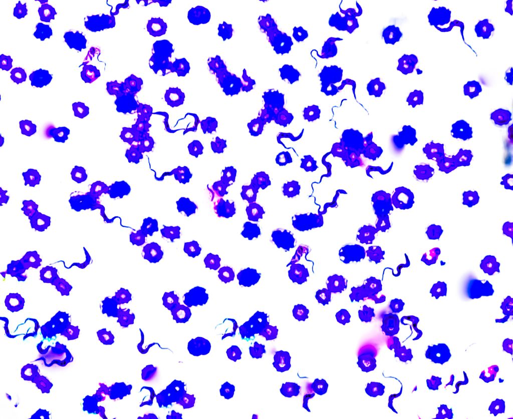 Trypanosoma spp. It's a protozoan parasites that cause serious diseases such as African sleeping sickness and Chagas disease. Micrograph Chagas disease, kissing bugs, Texas,